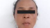 Foto ilustrativa de la nota titulada: Le desfigura el rostro a la amante de su marido tras enterarse de la infidelidad