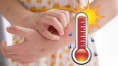 Consejos para tratar el sarpullido en los niños ante el calor extremo del verano